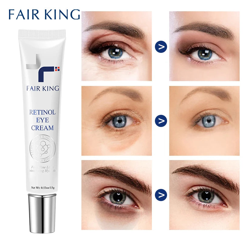 Retinol Eye Cream Eliminate Fine Lines Dark Circles Eye Bags Firming Skin Whitening Moisturizing