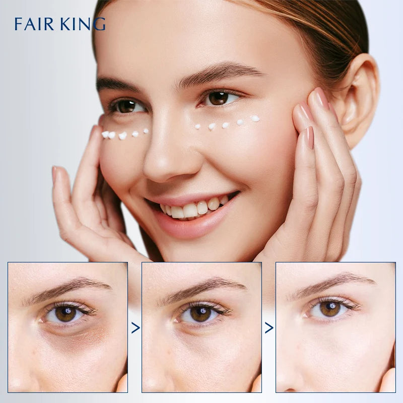 Retinol Eye Cream Eliminate Fine Lines Dark Circles Eye Bags Firming Skin Whitening Moisturizing