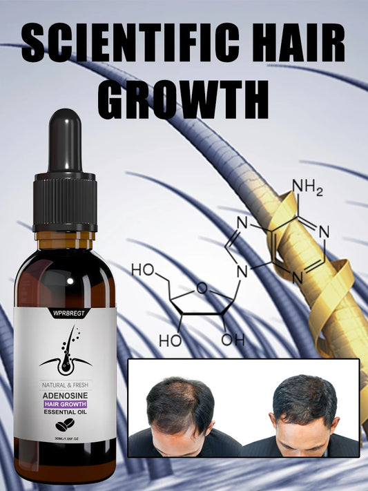 Hair Growth Essence Oil Products Effective Baldness Fast Repair Treatment